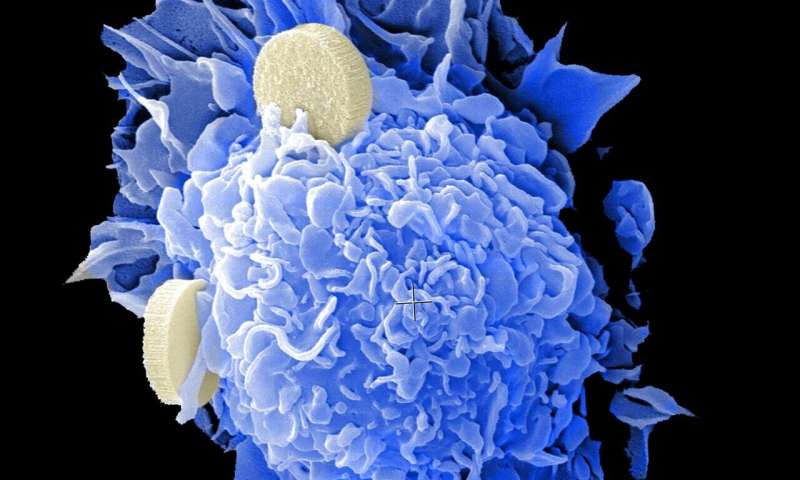 Breakthrough KRAS Protein Degrader Offers Hope for Cancer Treatment