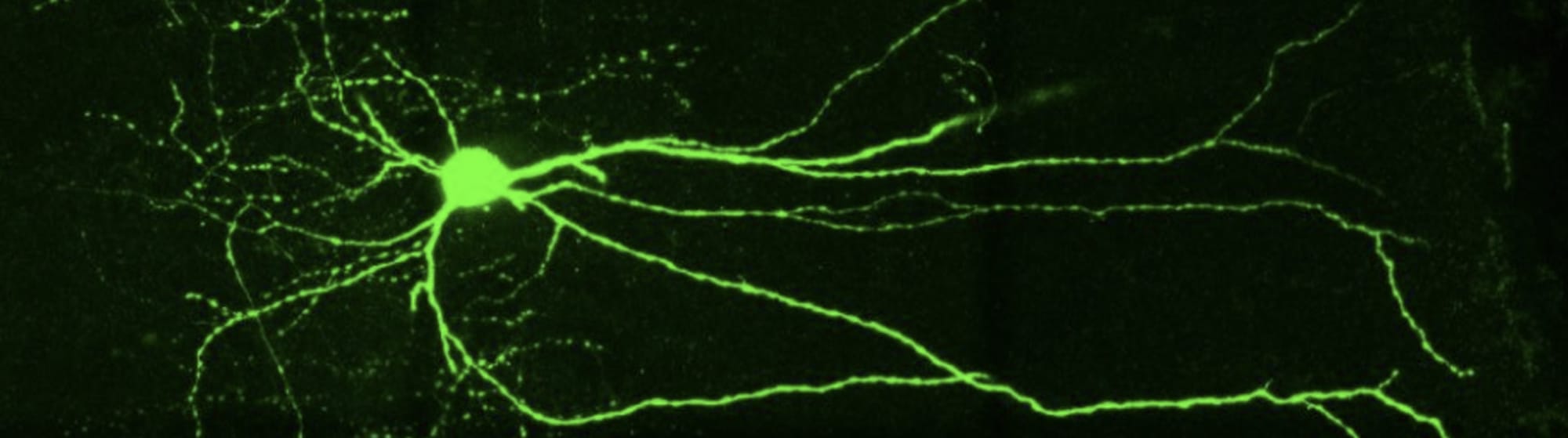 Huntingtin Protein Dysfunction Impairs DNA Repair in Huntington Disease