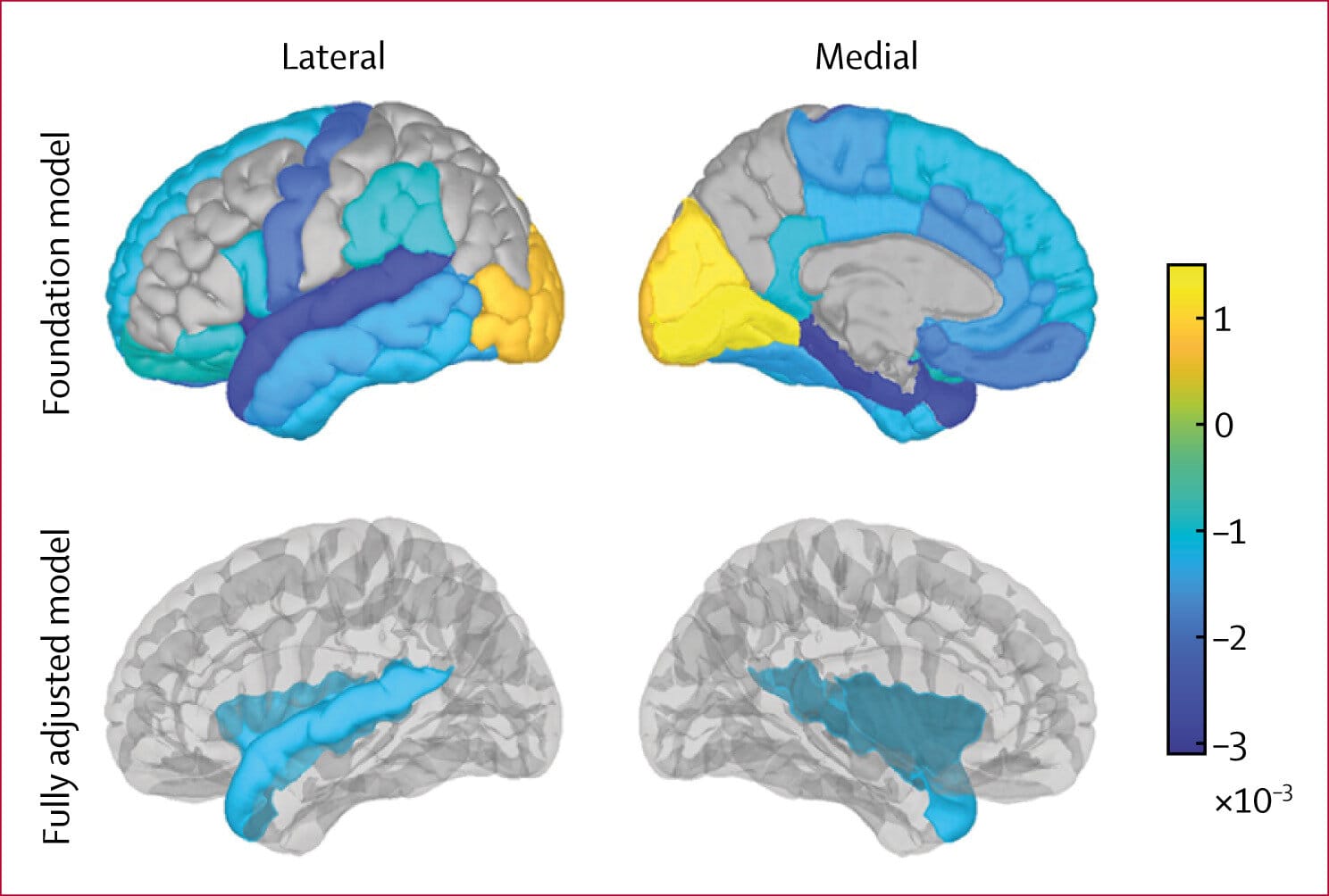 Multiple Surgeries Linked to Cognitive Decline in Older Adults