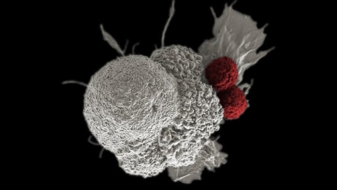 New Gene Therapy Reprograms Tumor Cells into Immune Cells for Cancer Treatment